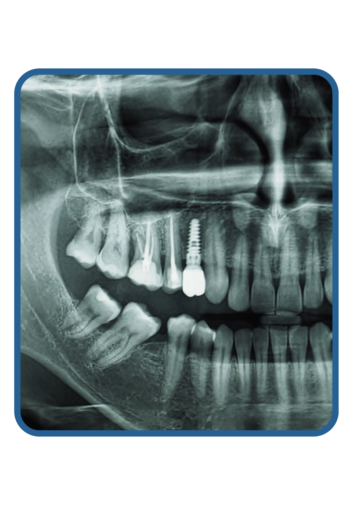 Perfil de Egreso - Odontología